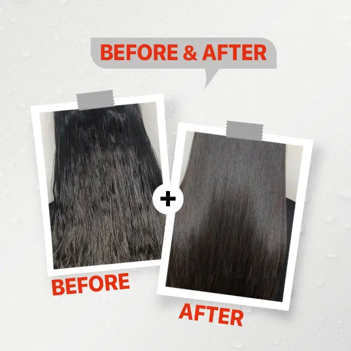 FirstVoc Anti-Dandruff Shampoo